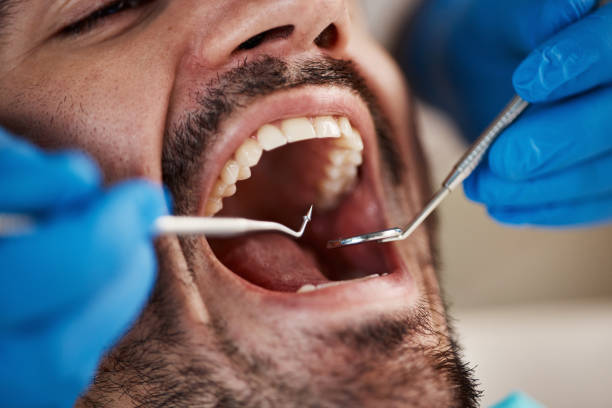 Professional Emergency Dentist in GA